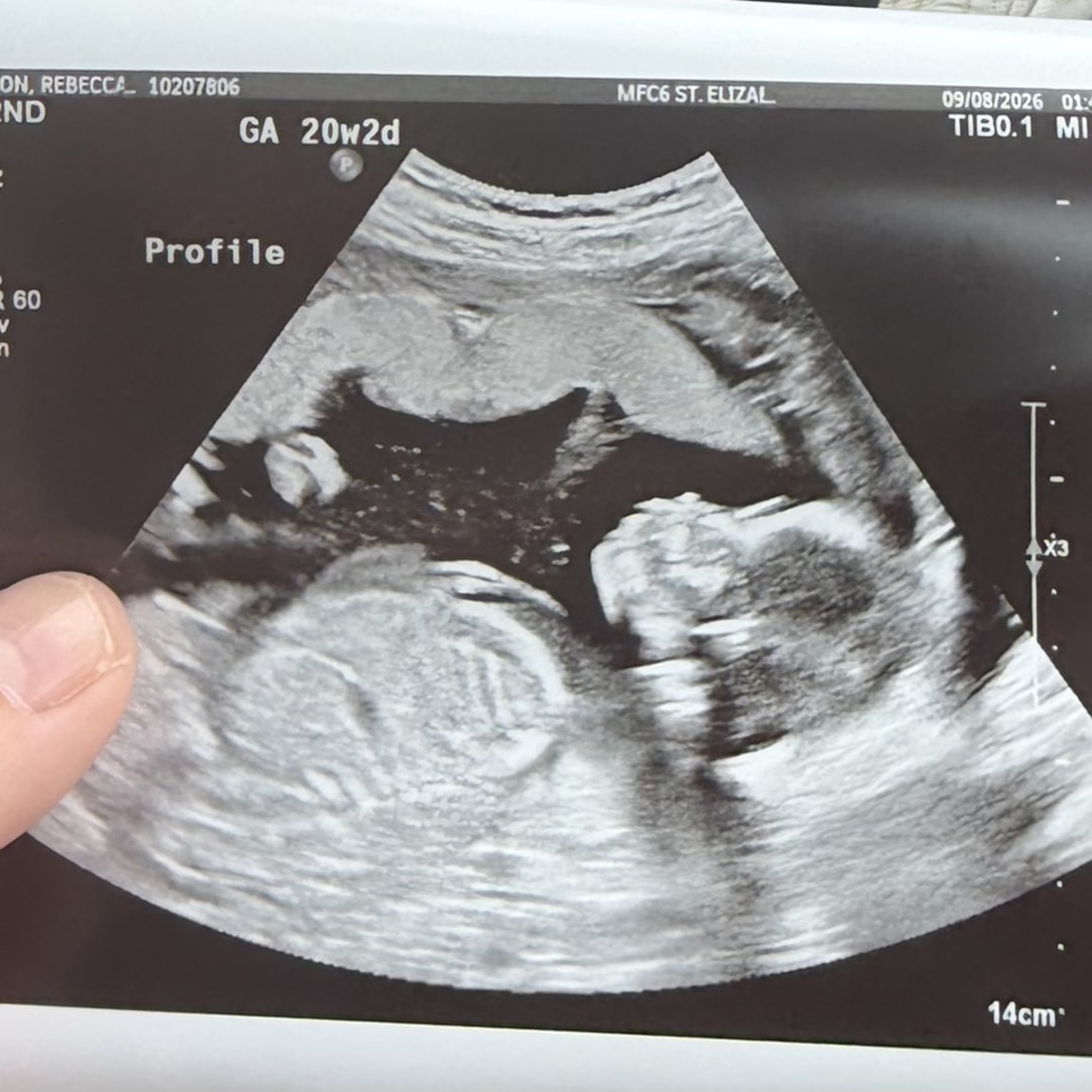 Photo shared by Rebecca for their Babylist baby registry.