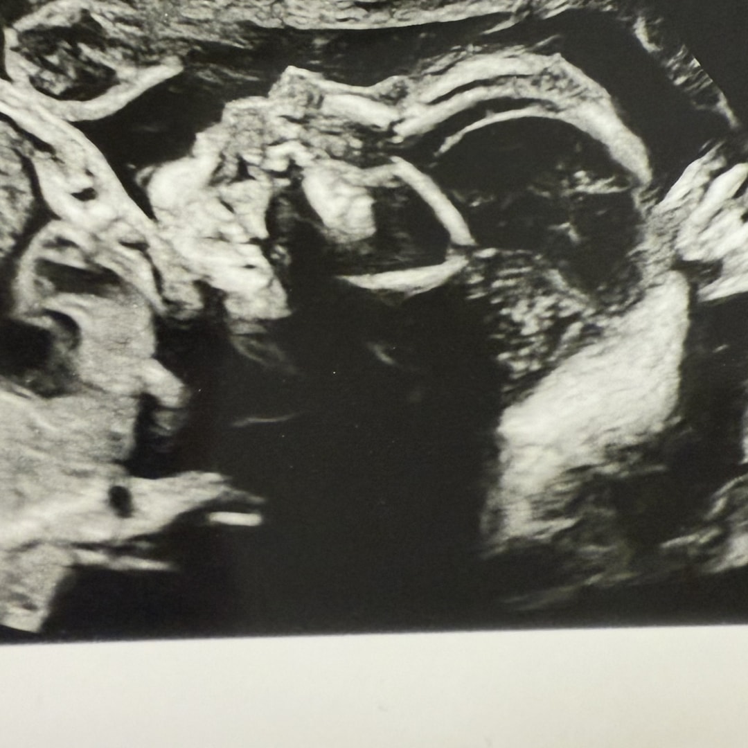 Photo shared by Marina for their Babylist baby registry.