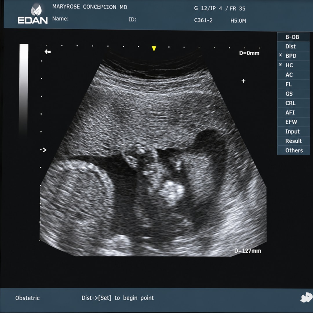 Photo shared by Amanda for their Babylist baby registry.
