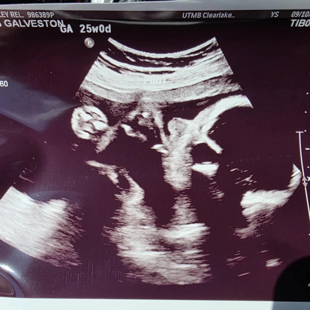 Photo shared by Ashley for their Babylist baby registry.