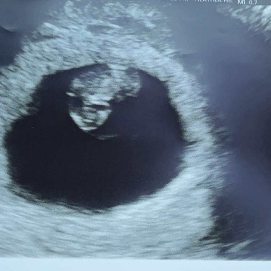 Photo shared by Jayden for their Babylist baby registry.