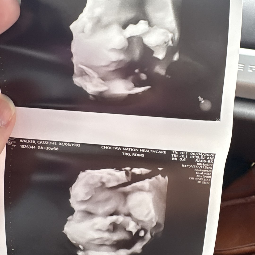 Photo shared by Cassidhe for their Babylist baby registry.