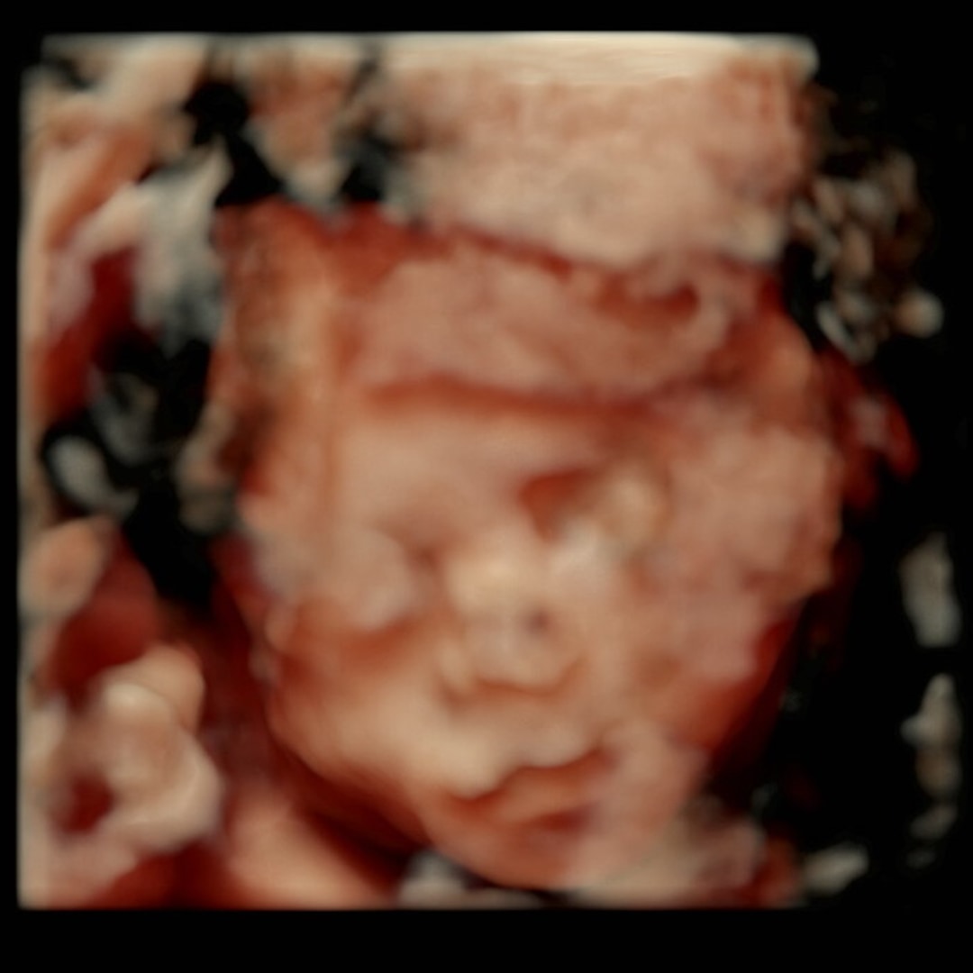 Photo shared by Jenna for their Babylist baby registry.