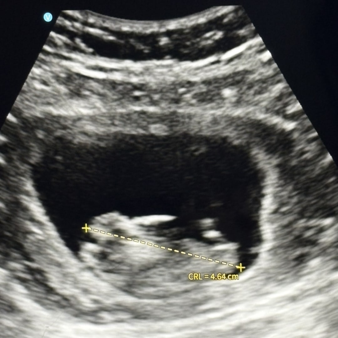 Photo shared by Darcy for their Babylist baby registry.