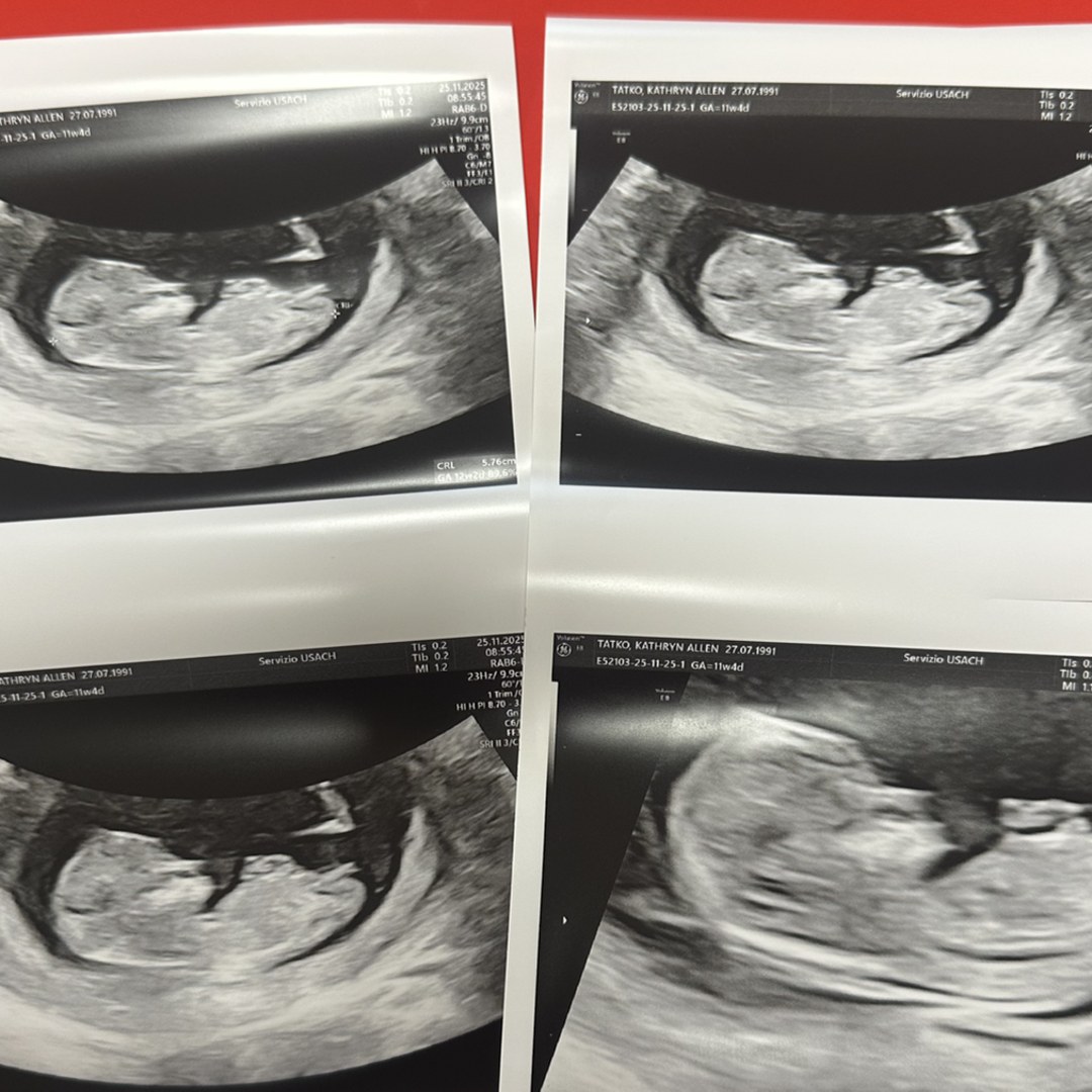 Photo shared by Katy for their Babylist baby registry.