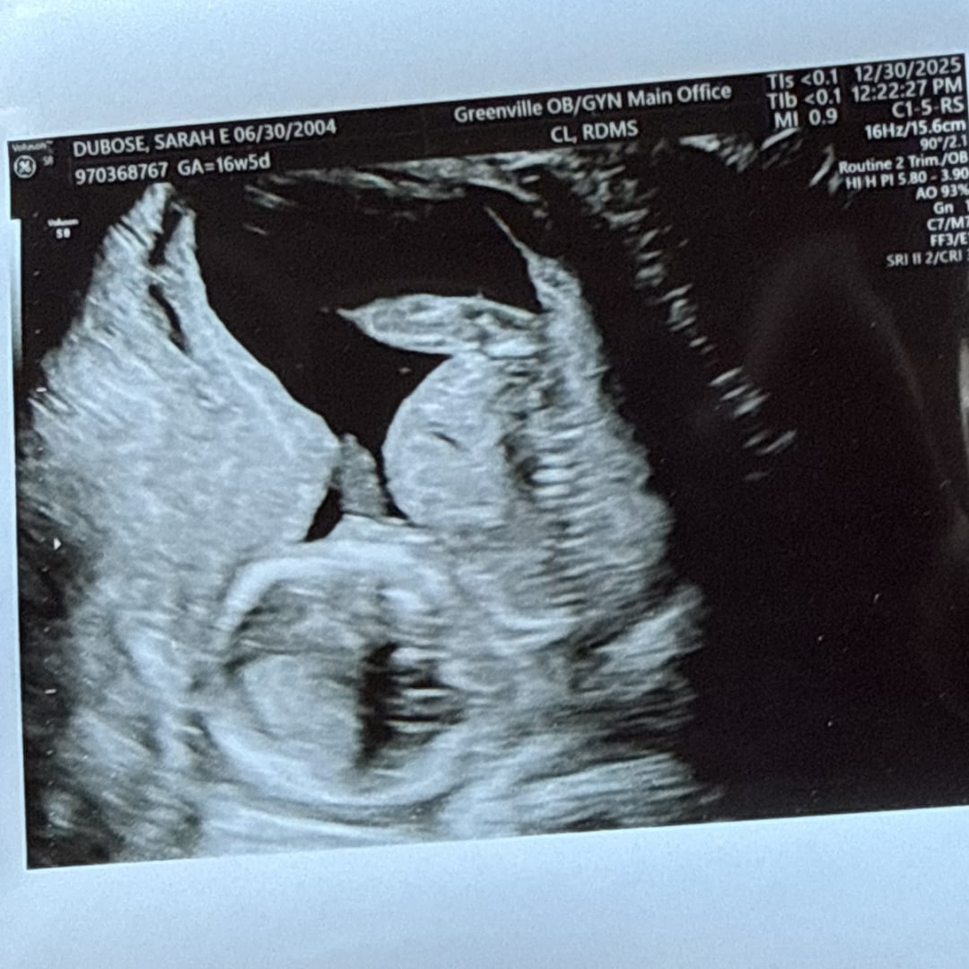 Photo shared by Sarah for their Babylist baby registry.