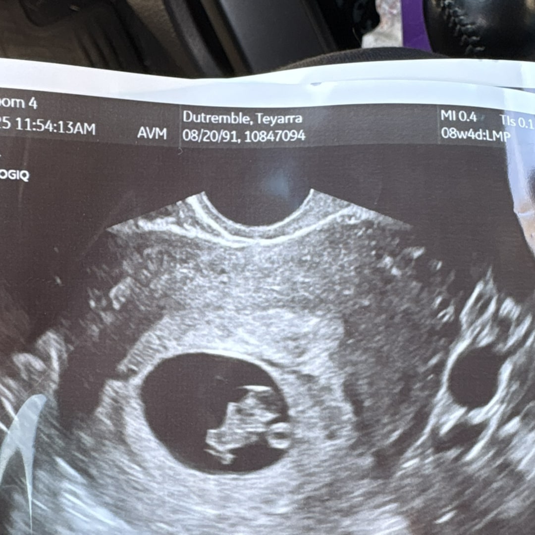 Photo shared by Teyarra for their Babylist baby registry.