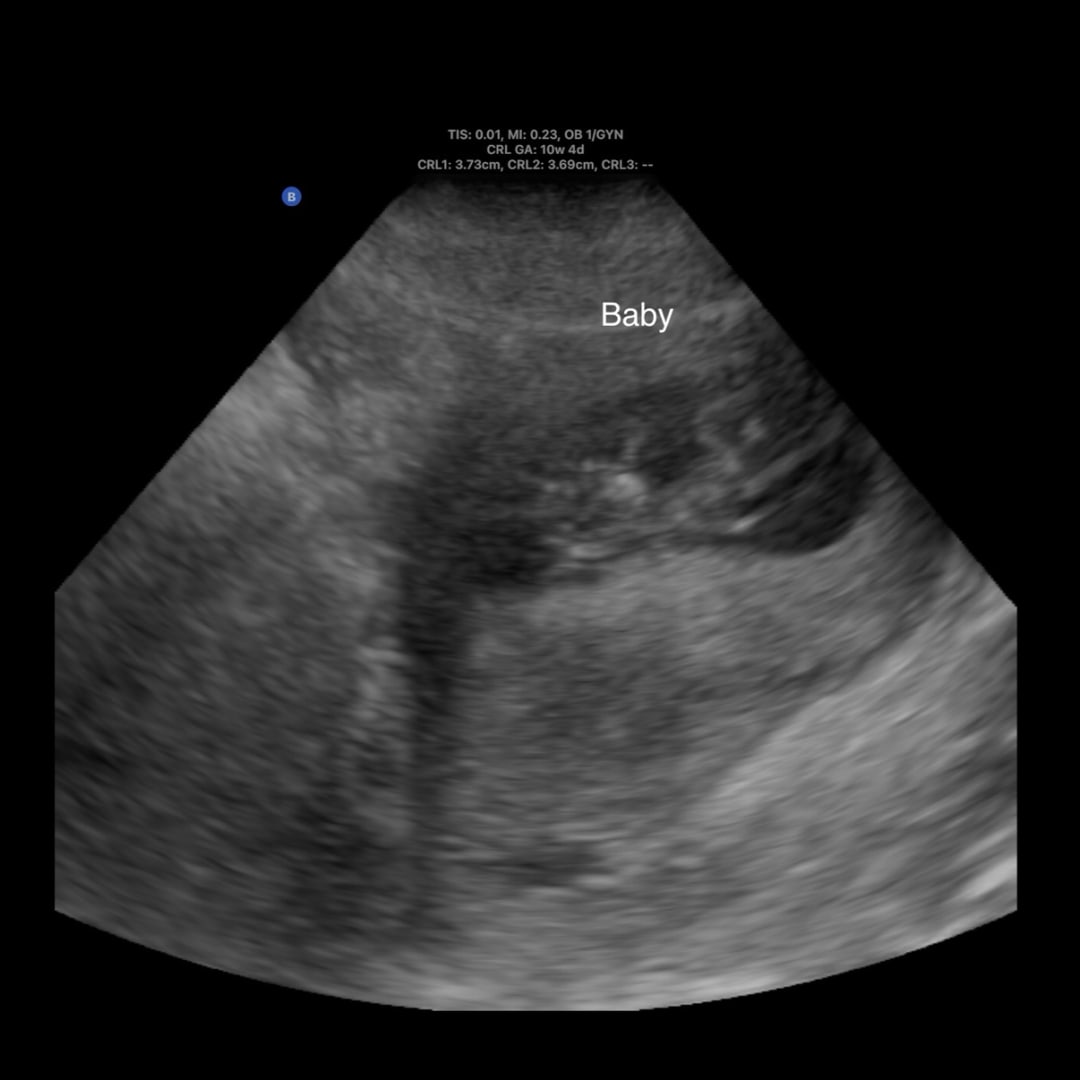 Photo shared by Noelle for their Babylist baby registry.