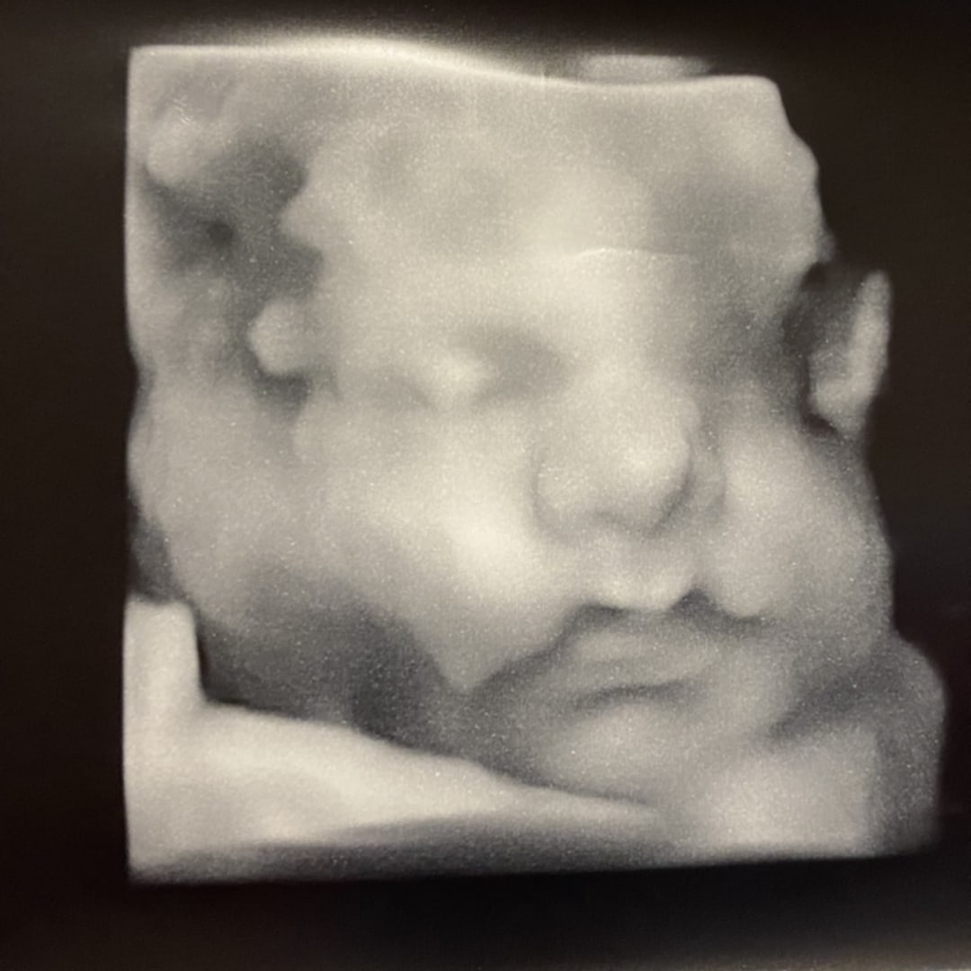 Photo shared by Tesia for their Babylist baby registry.
