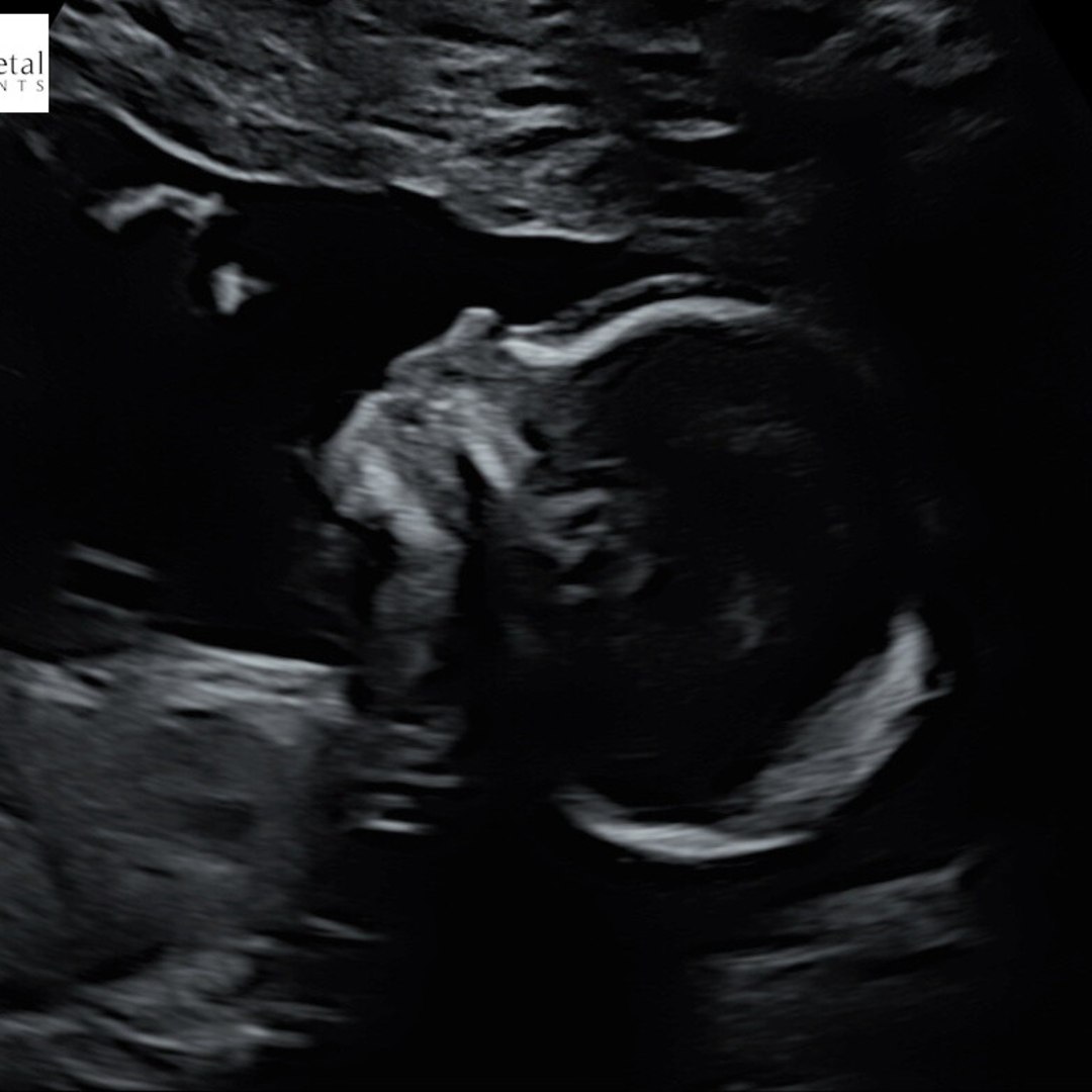 Photo shared by Emily for their Babylist baby registry.