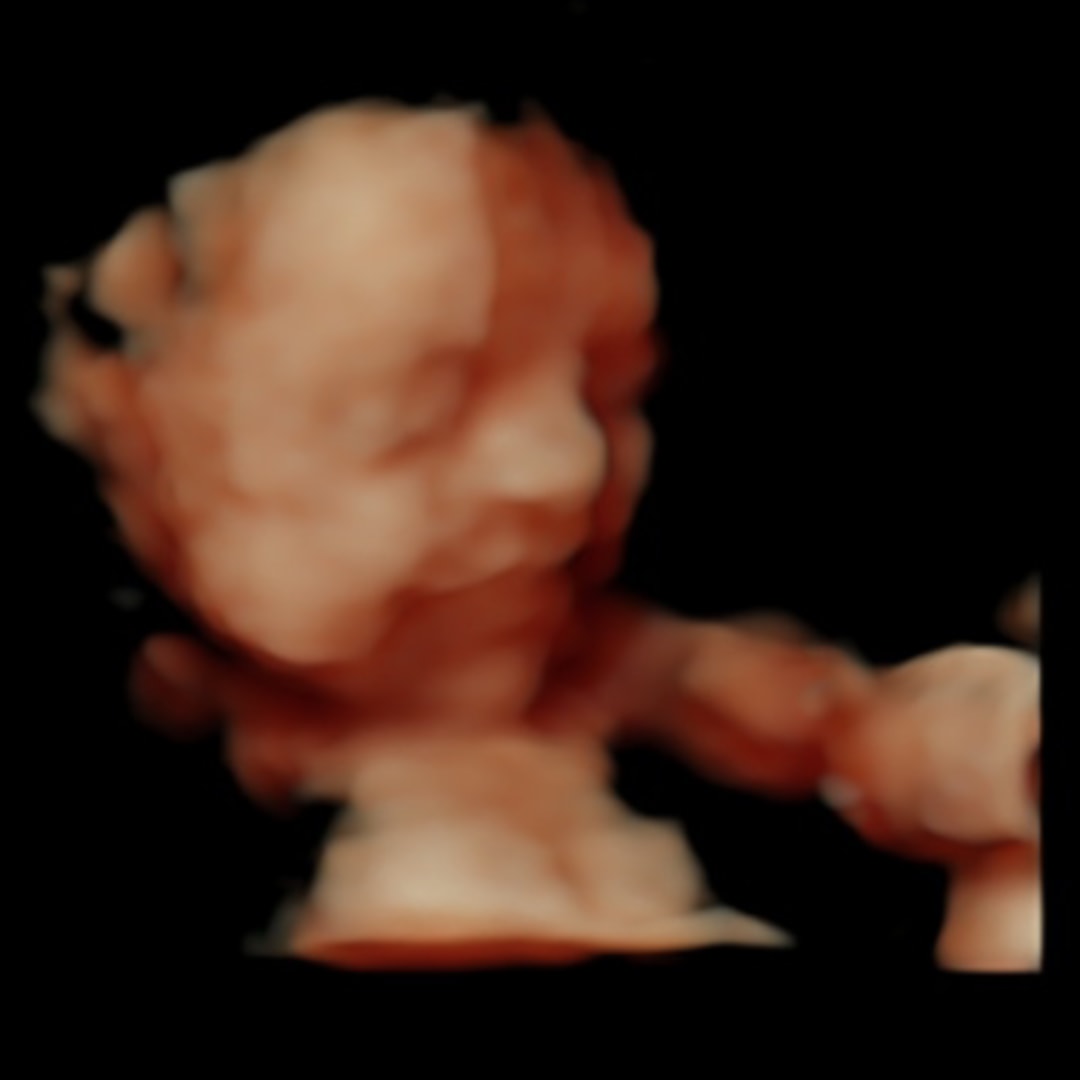 Photo shared by Cheyenne for their Babylist baby registry.