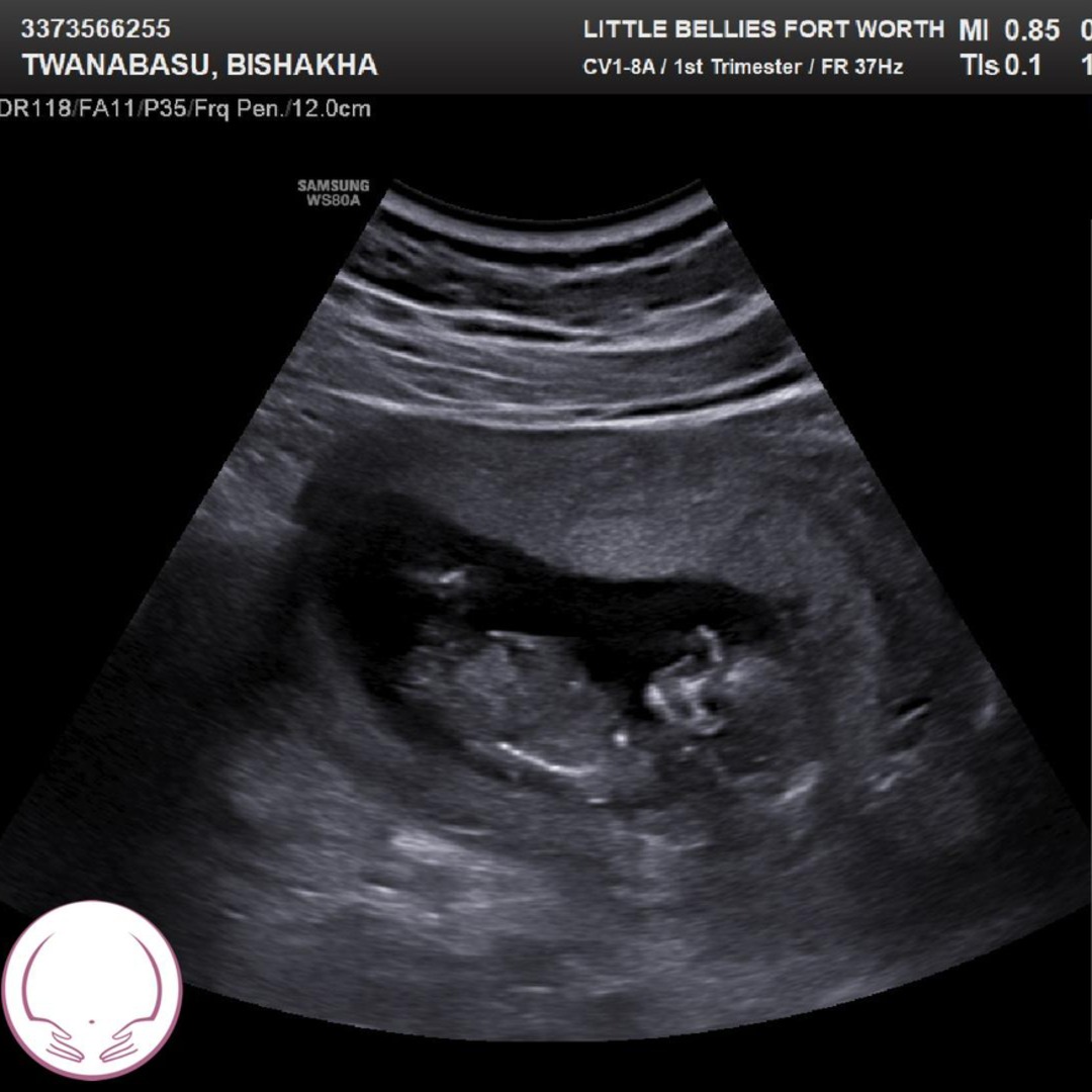 Photo shared by Bishakha for their Babylist baby registry.