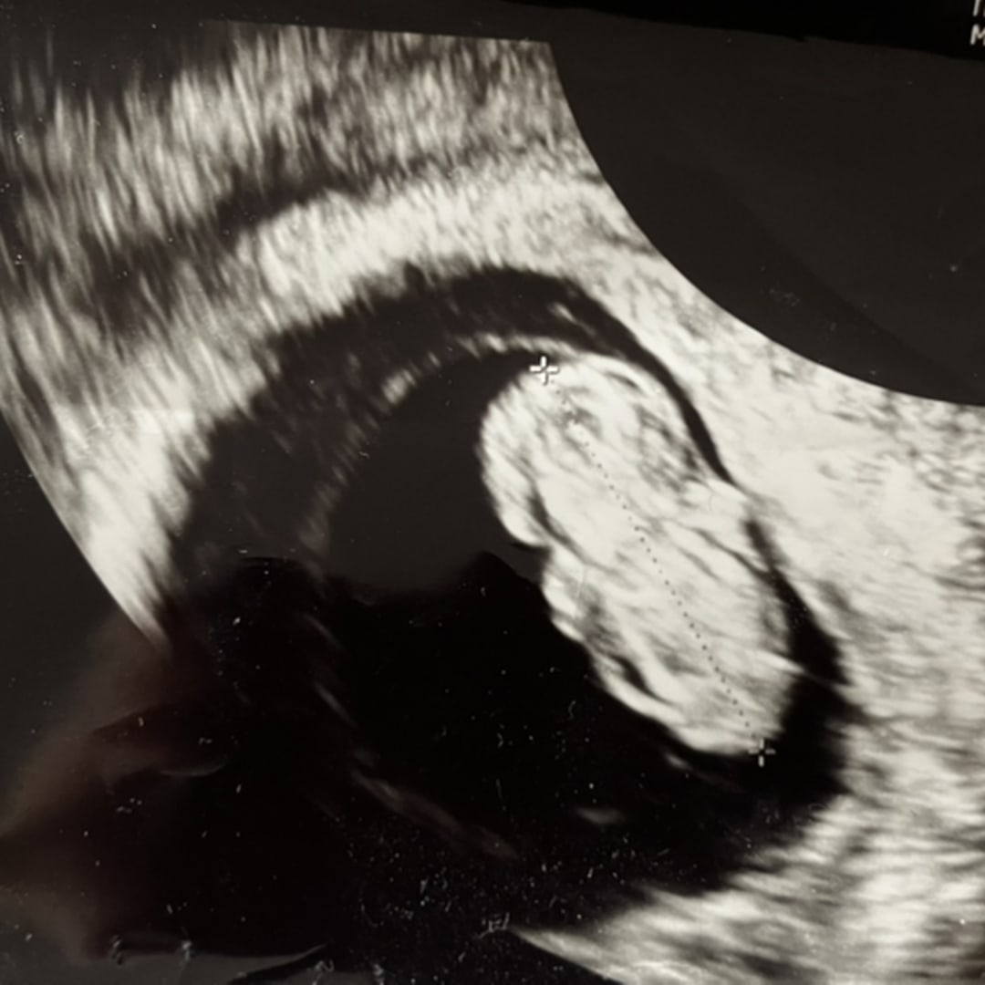 Photo shared by Cynthia for their Babylist baby registry.