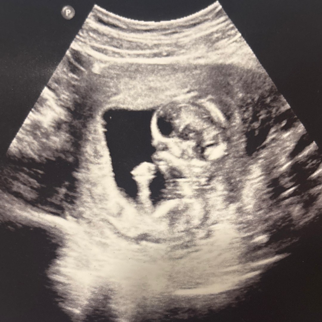 Photo shared by Emmah for their Babylist baby registry.
