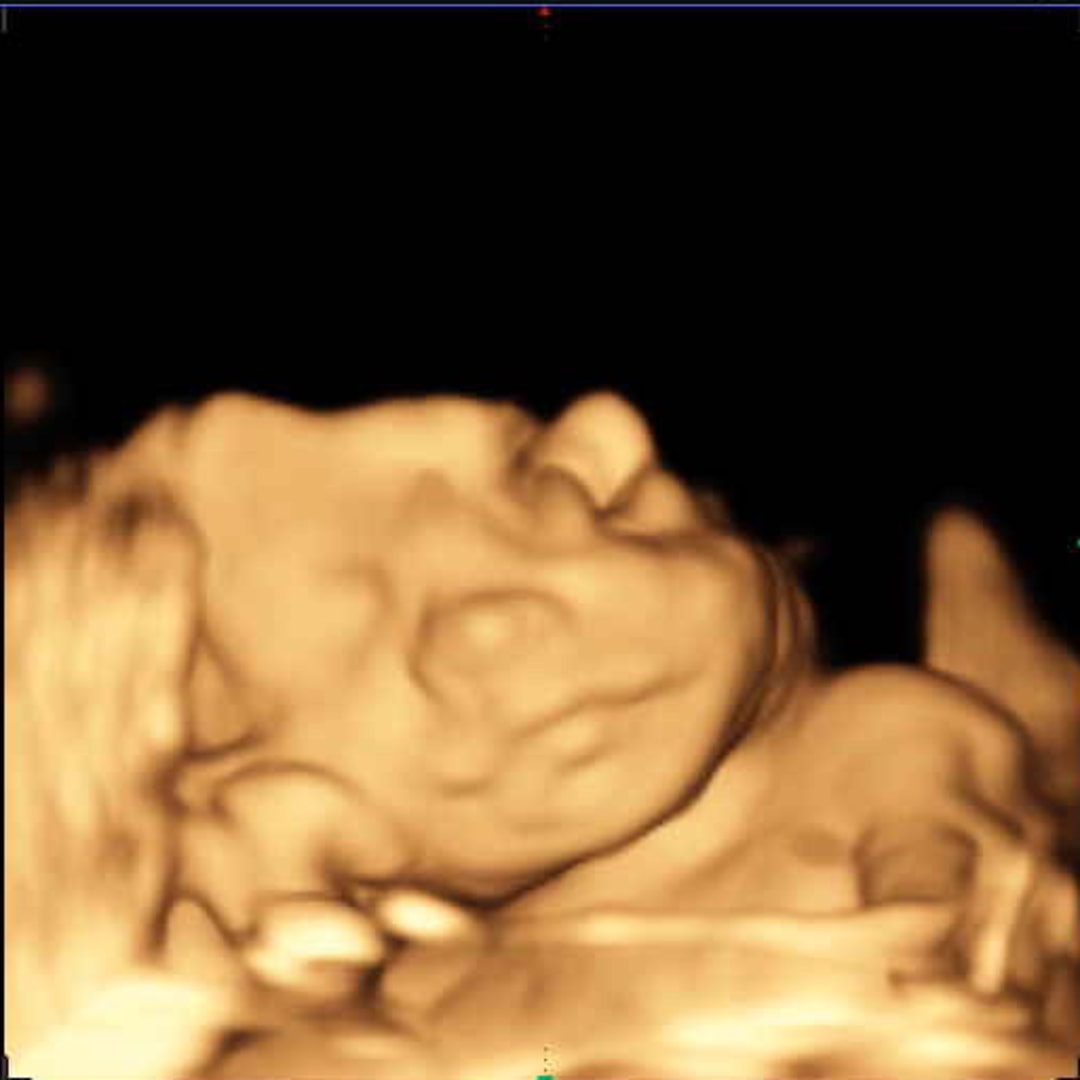 Photo shared by McCall for their Babylist baby registry.
