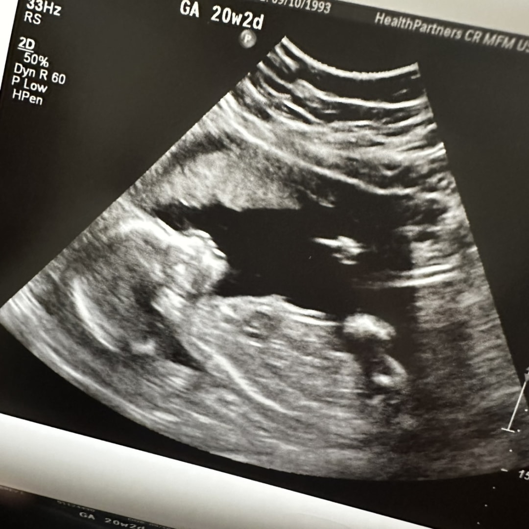 Photo shared by Aubrey for their Babylist baby registry.