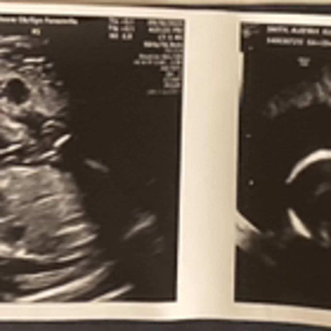 Photo shared by Aleeyah for their Babylist baby registry.