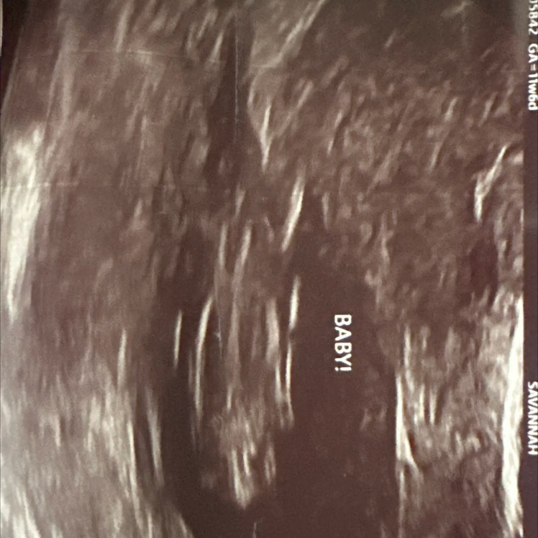 Photo shared by Ailene for their Babylist baby registry.