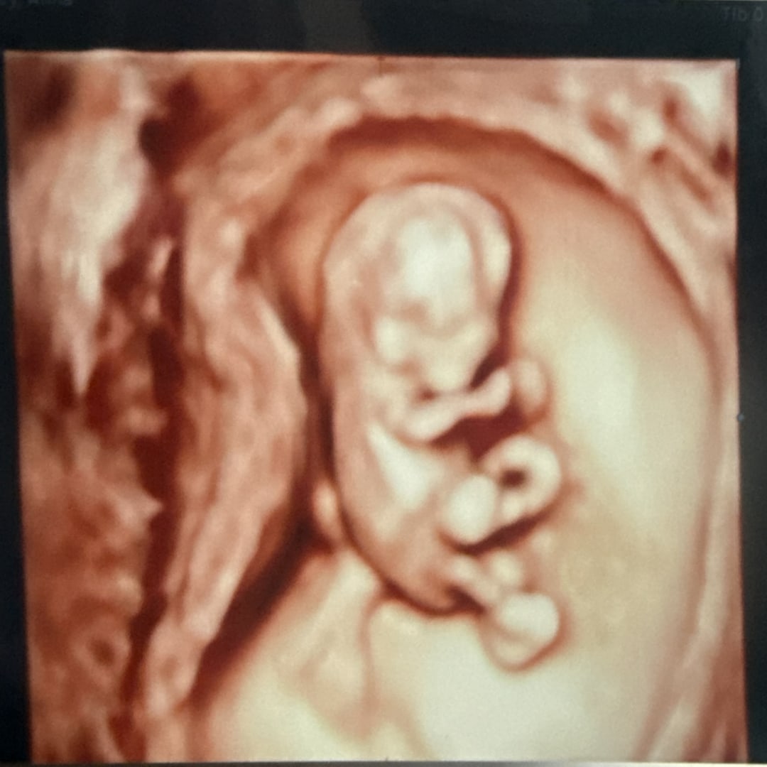Photo shared by Anna for their Babylist baby registry.
