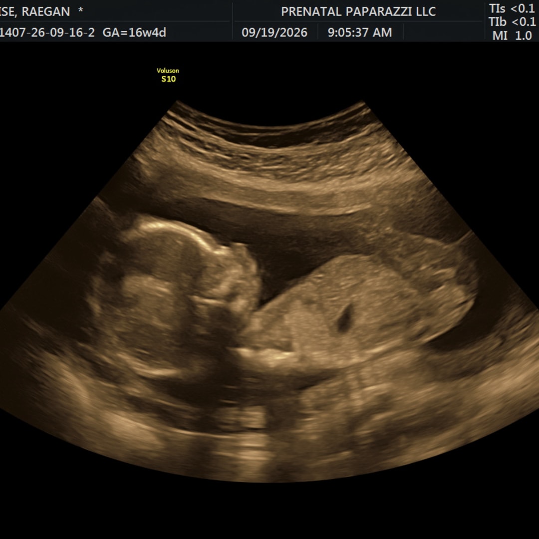 Photo shared by Raegan for their Babylist baby registry.