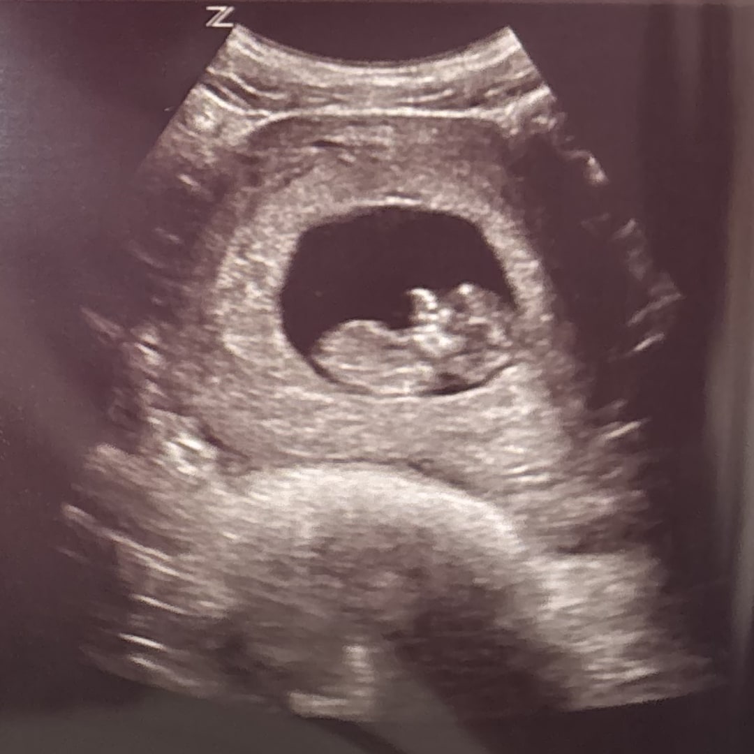 Photo shared by Kimeiko for their Babylist baby registry.