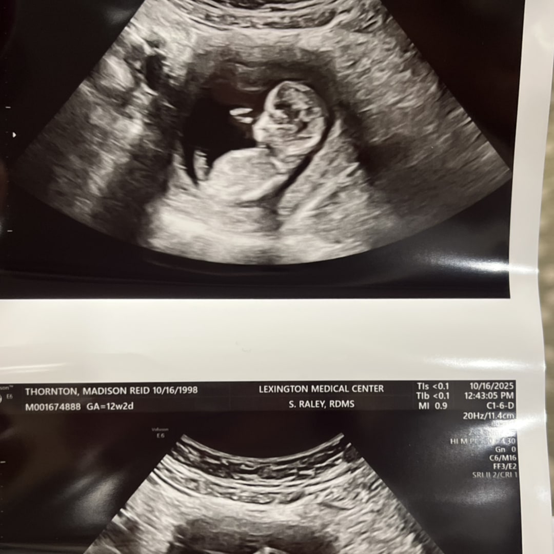 Photo shared by Madison for their Babylist baby registry.