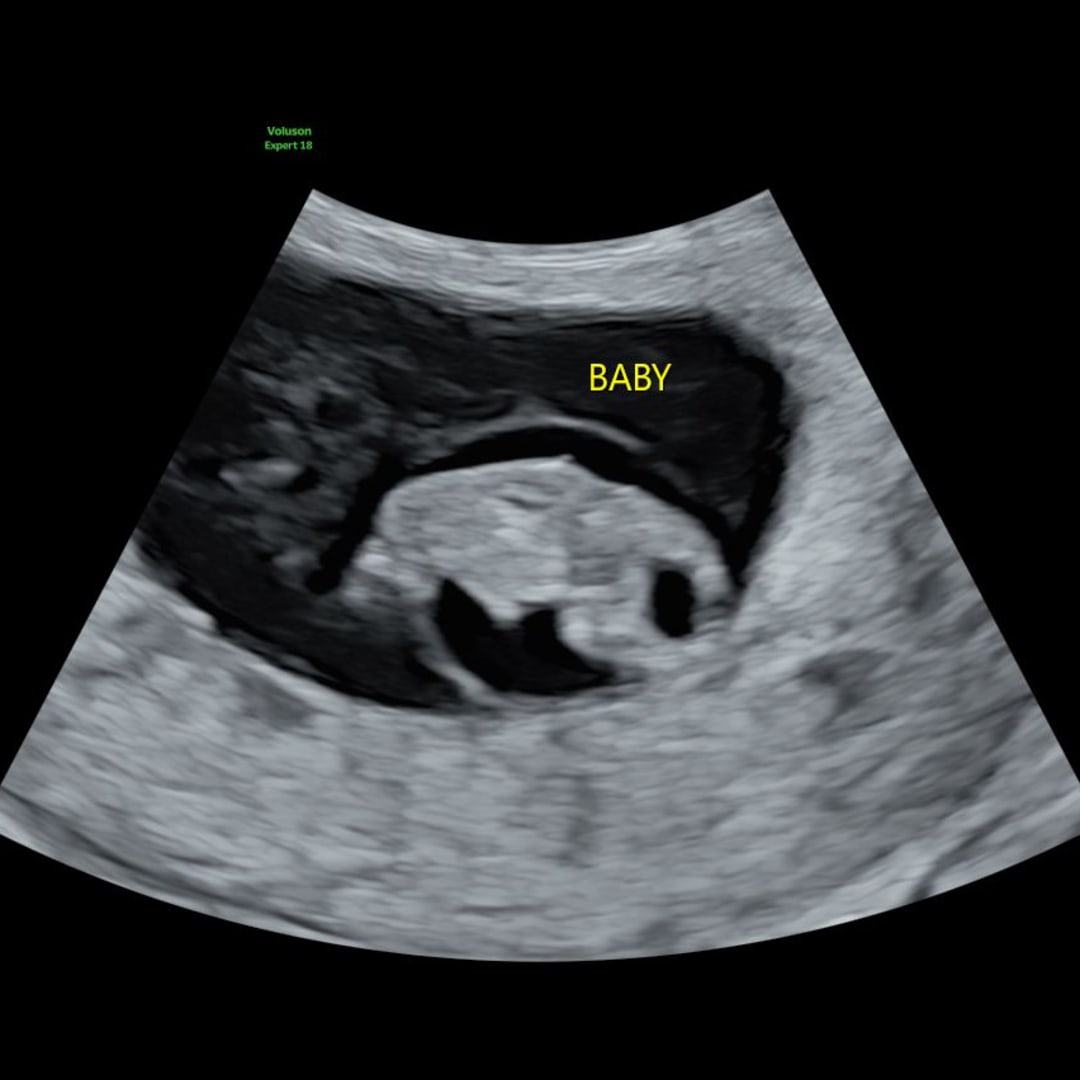 Photo shared by Aryanna for their Babylist baby registry.