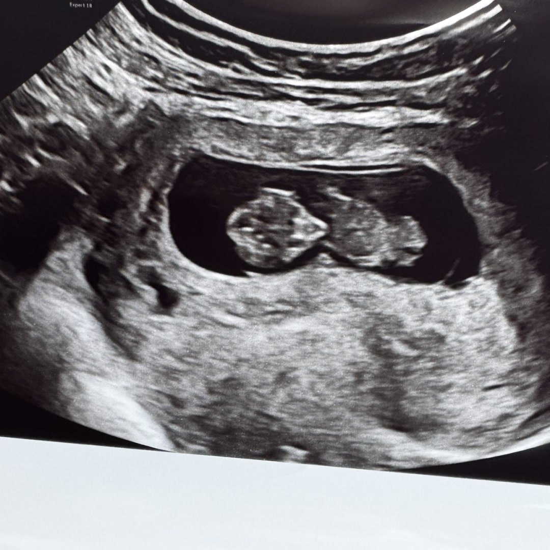 Photo shared by Hannah Strong for their Babylist baby registry.