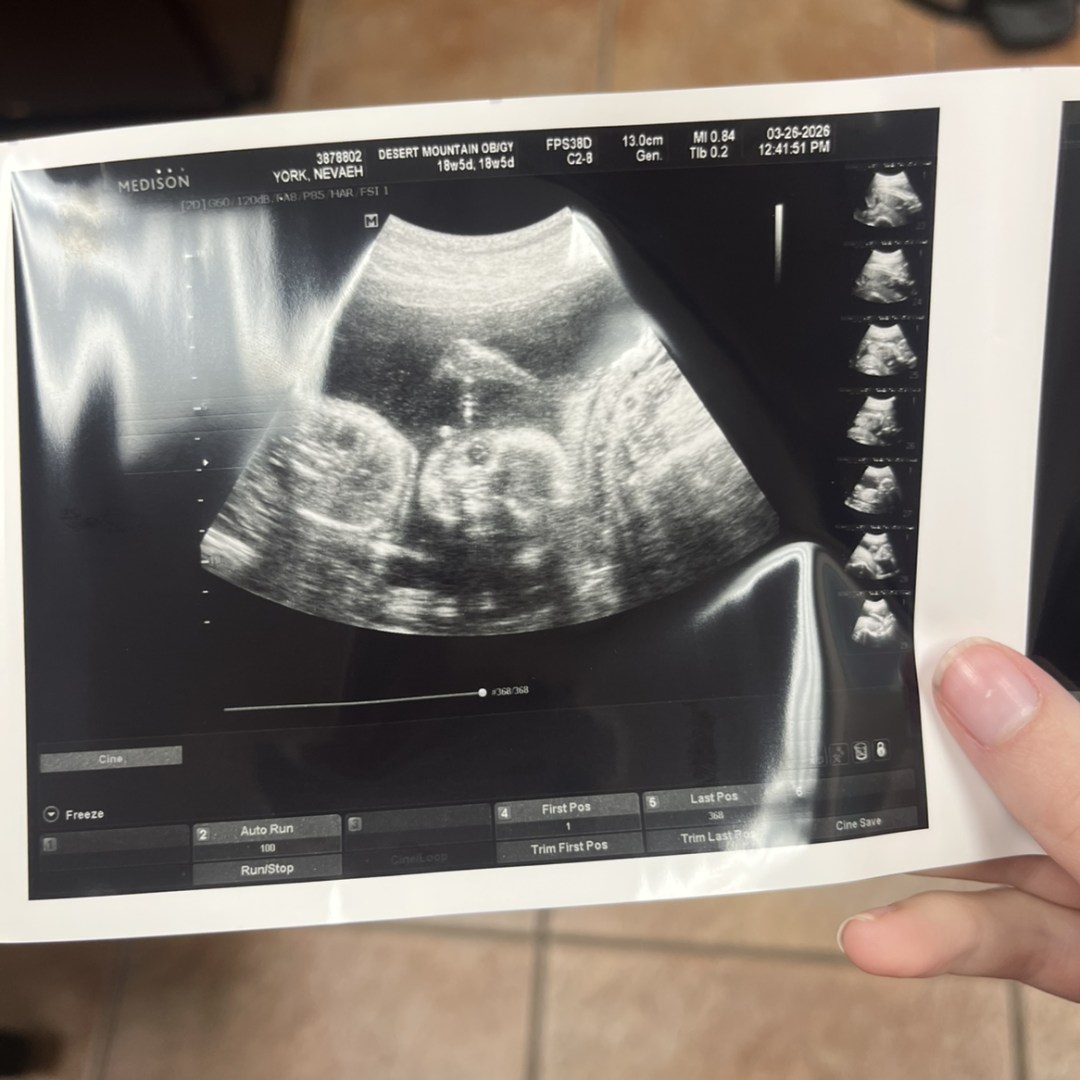 Photo shared by Nevaeh for their Babylist baby registry.