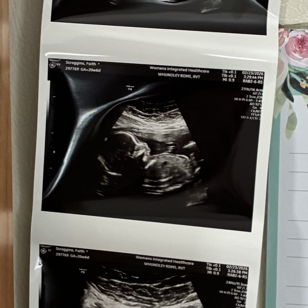 Photo shared by Thackery for their Babylist baby registry.