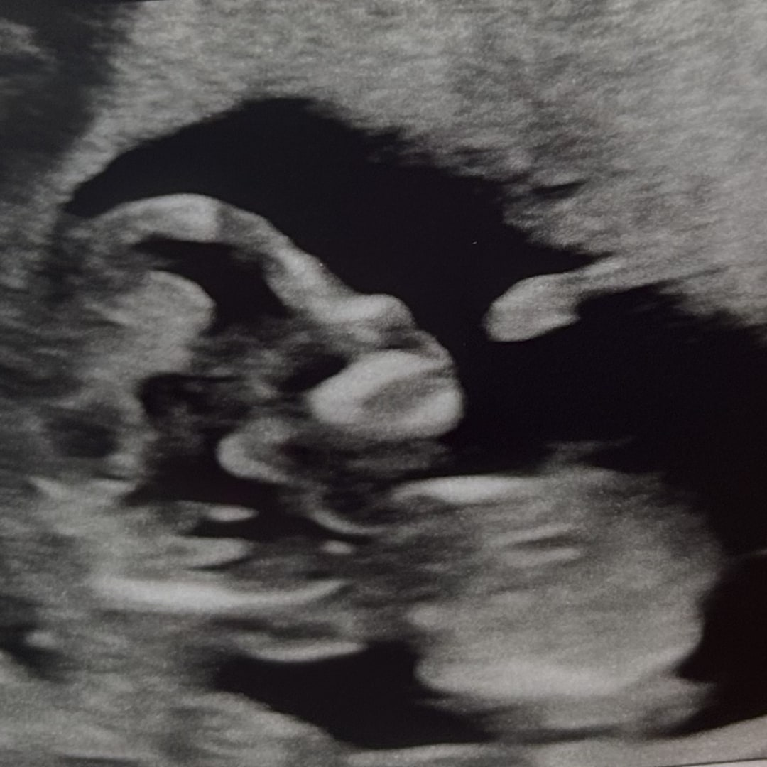 Photo shared by Cierra for their Babylist baby registry.