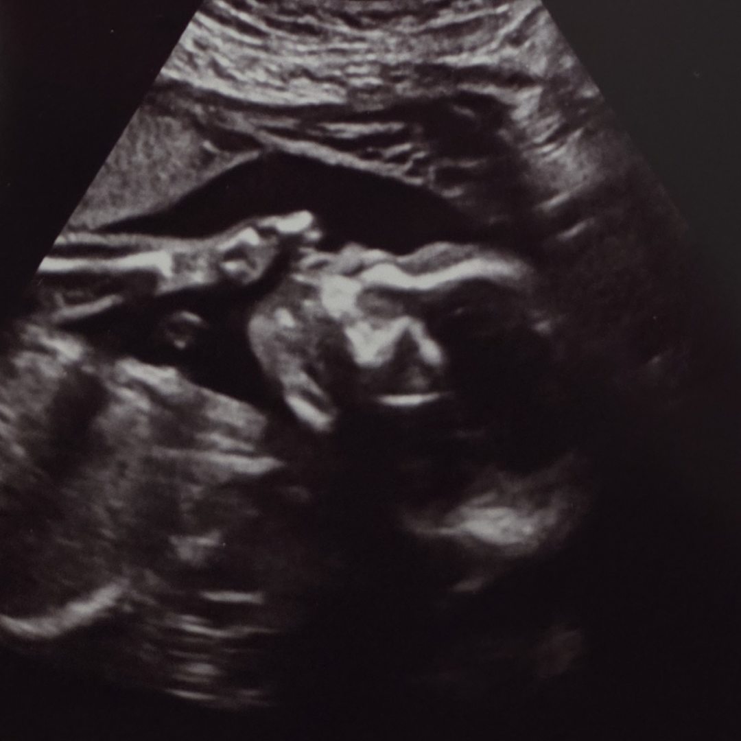 Photo shared by Hannah for their Babylist baby registry.