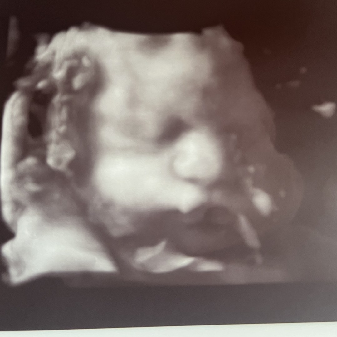Photo shared by Evelyn for their Babylist baby registry.
