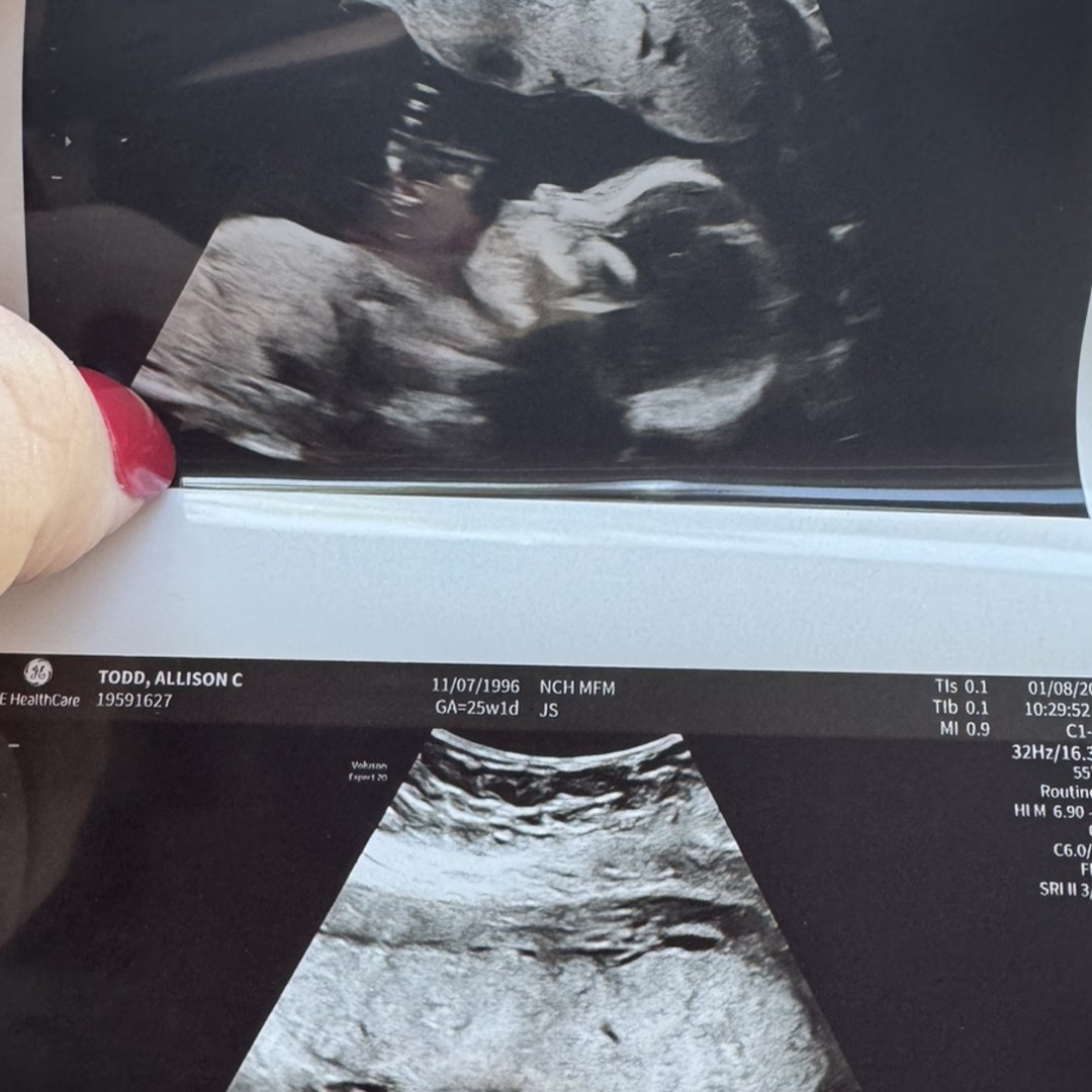 Photo shared by Allie for their Babylist baby registry.