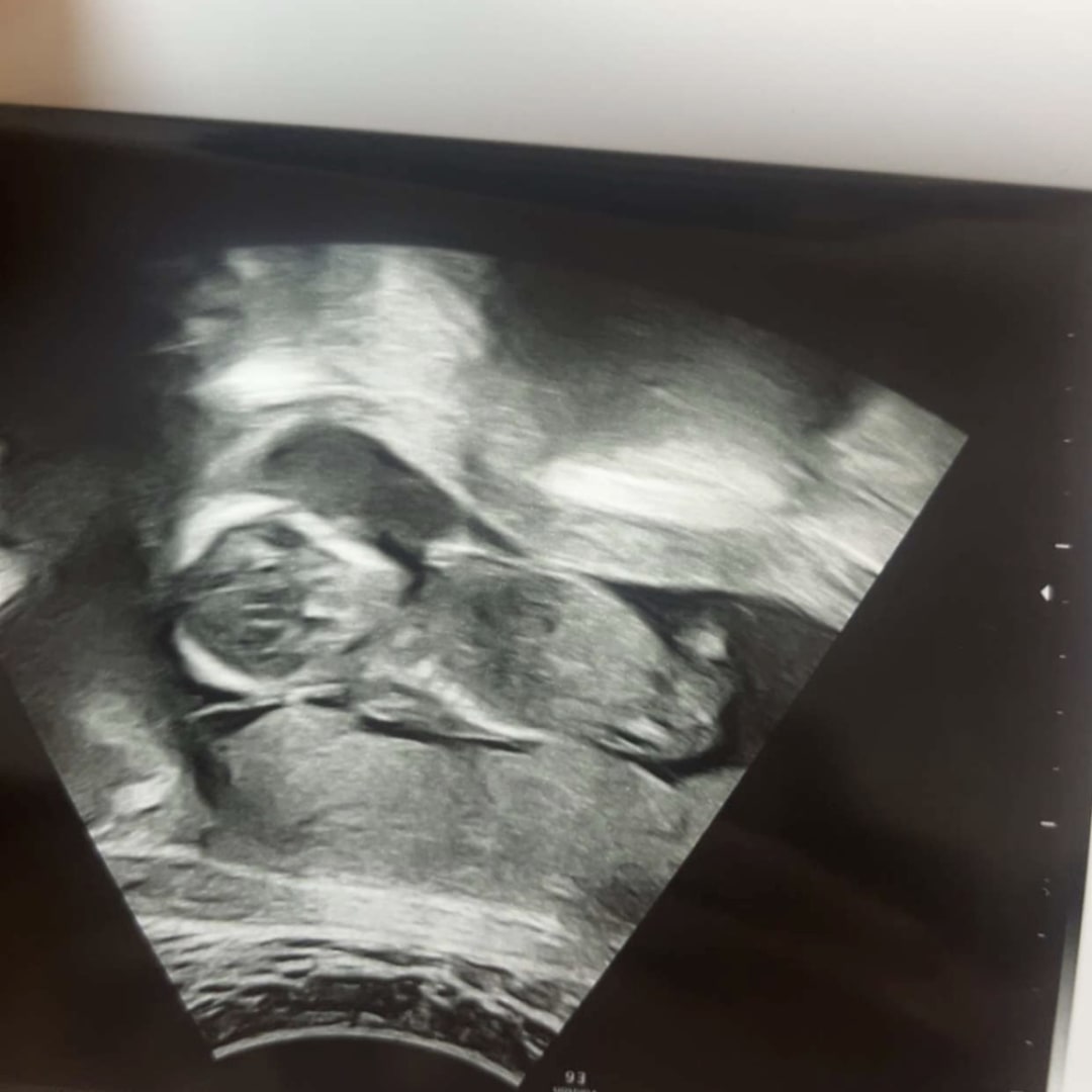 Photo shared by Scarlett for their Babylist baby registry.