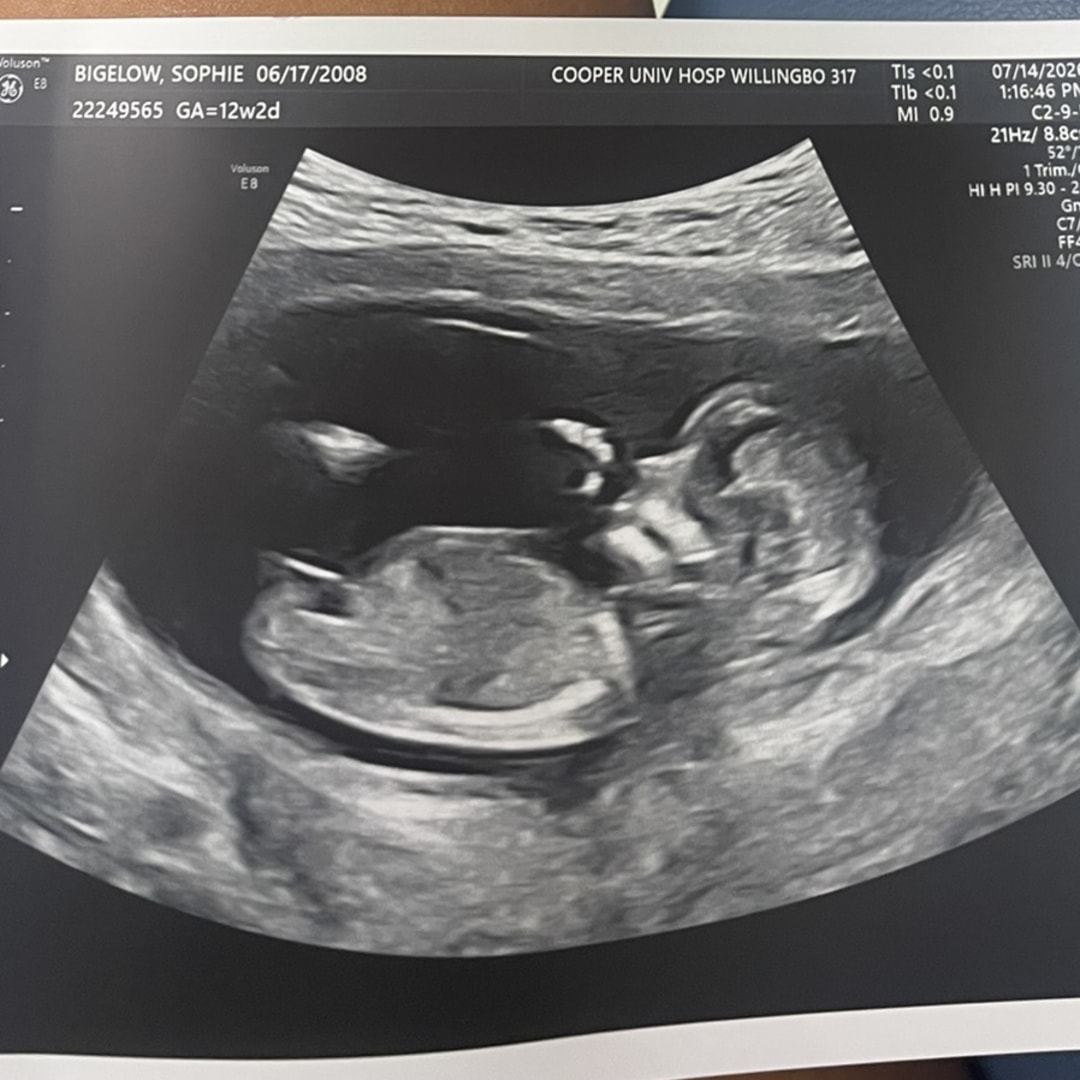 Photo shared by Sophie for their Babylist baby registry.