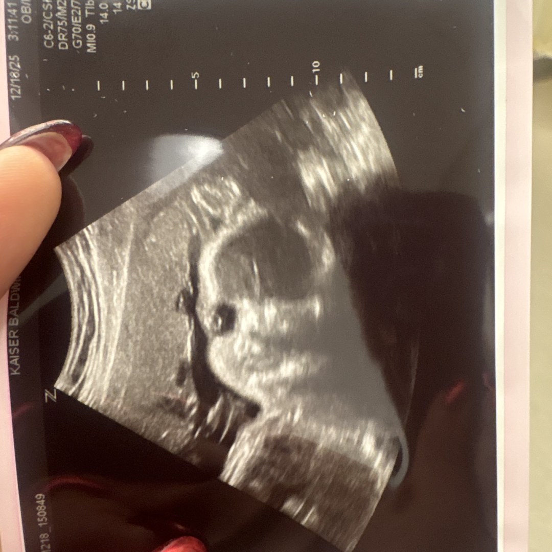 Photo shared by Mallery for their Babylist baby registry.