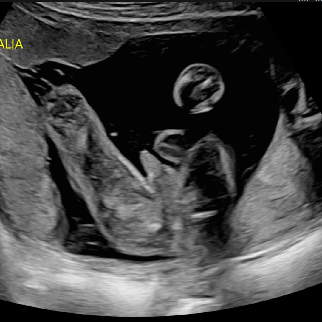 Photo shared by Trinity for their Babylist baby registry.