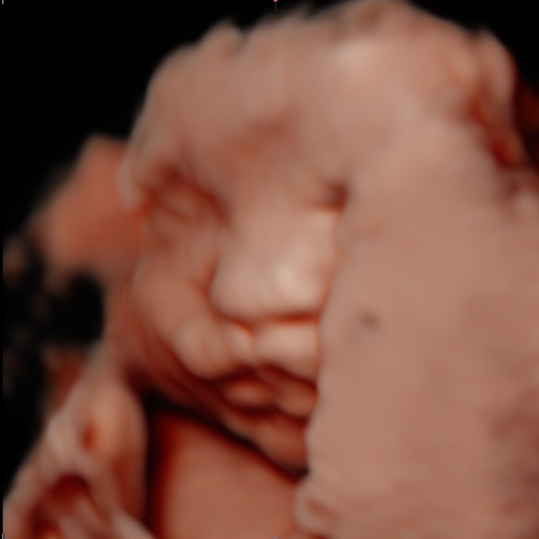 Photo shared by Emily for their Babylist baby registry.