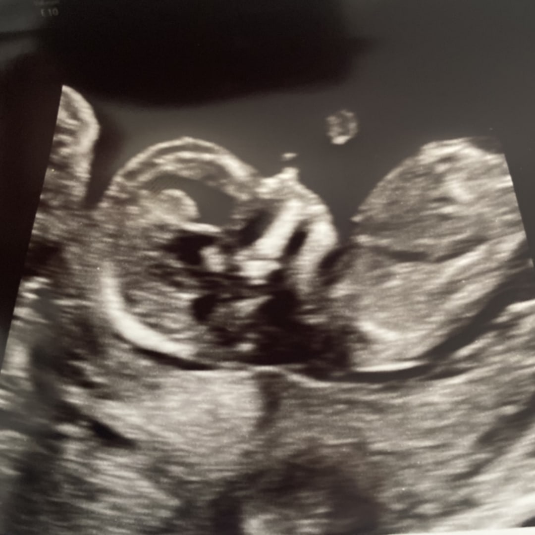Photo shared by Trinity for their Babylist baby registry.