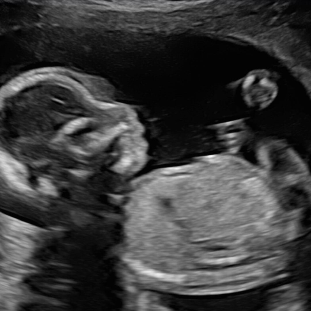 Photo shared by Grace for their Babylist baby registry.