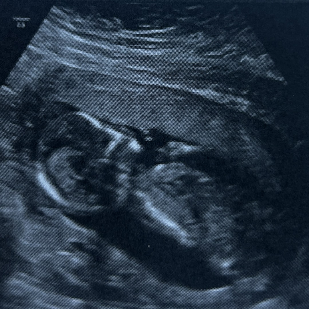 Photo shared by Alyssa for their Babylist baby registry.