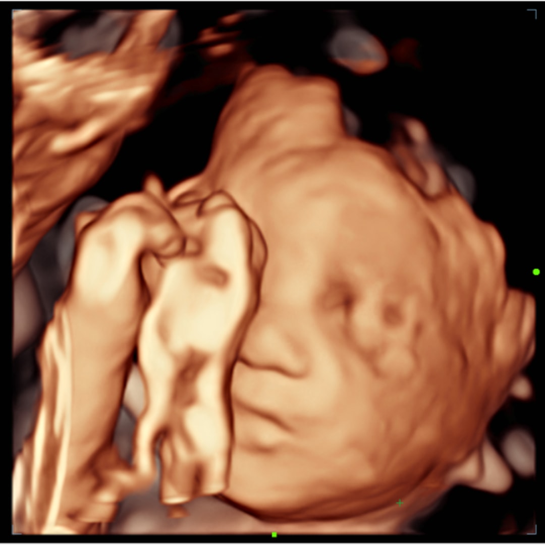 Photo shared by Hannah for their Babylist baby registry.