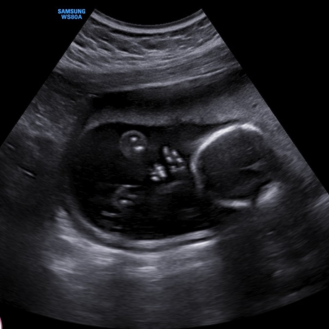 Photo shared by Brilly for their Babylist baby registry.