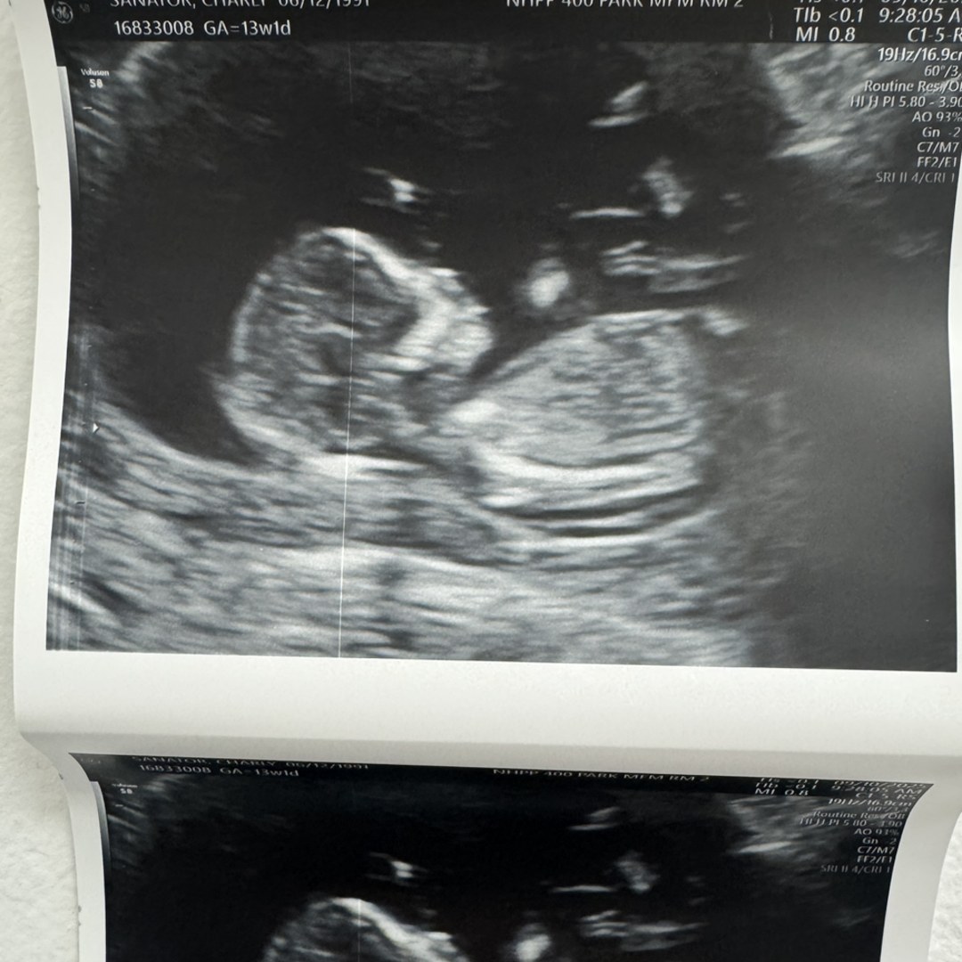 Photo shared by Charly for their Babylist baby registry.