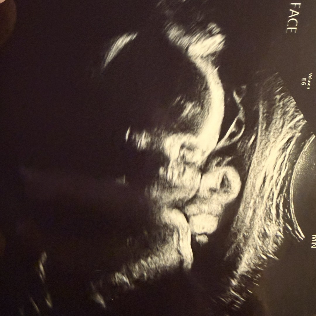 Photo shared by Ileana for their Babylist baby registry.