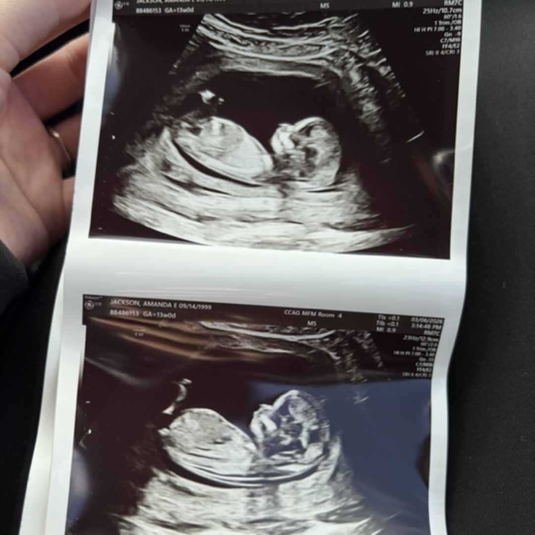 Photo shared by Amanda for their Babylist baby registry.