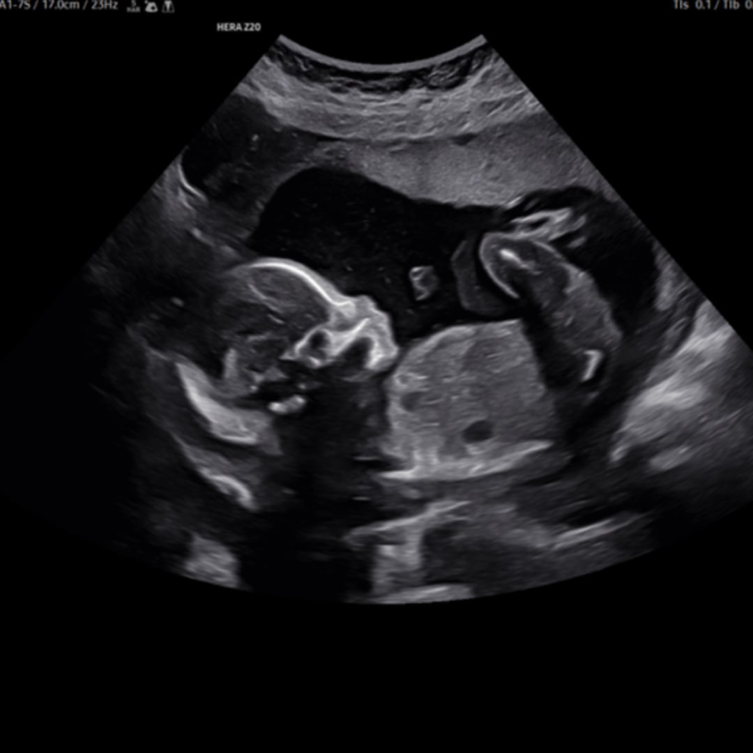 Photo shared by Yuleimy for their Babylist baby registry.