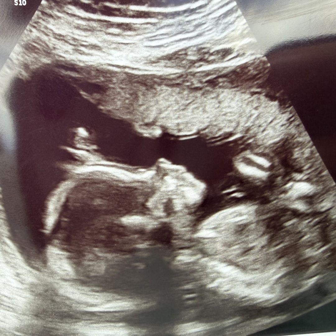 Photo shared by Bethany for their Babylist baby registry.
