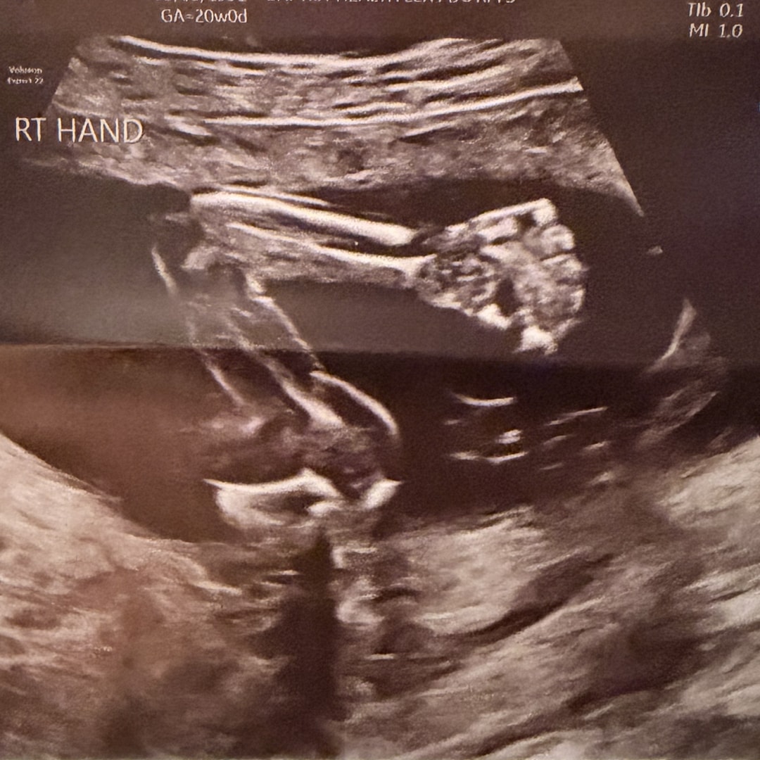 Photo shared by Samantha for their Babylist baby registry.